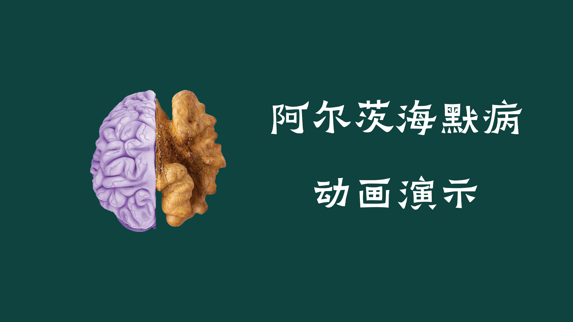 阿尔茨海默病