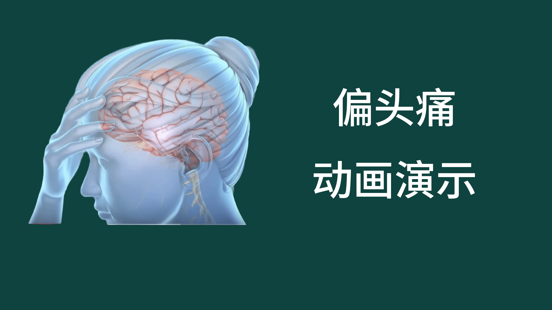 偏头痛