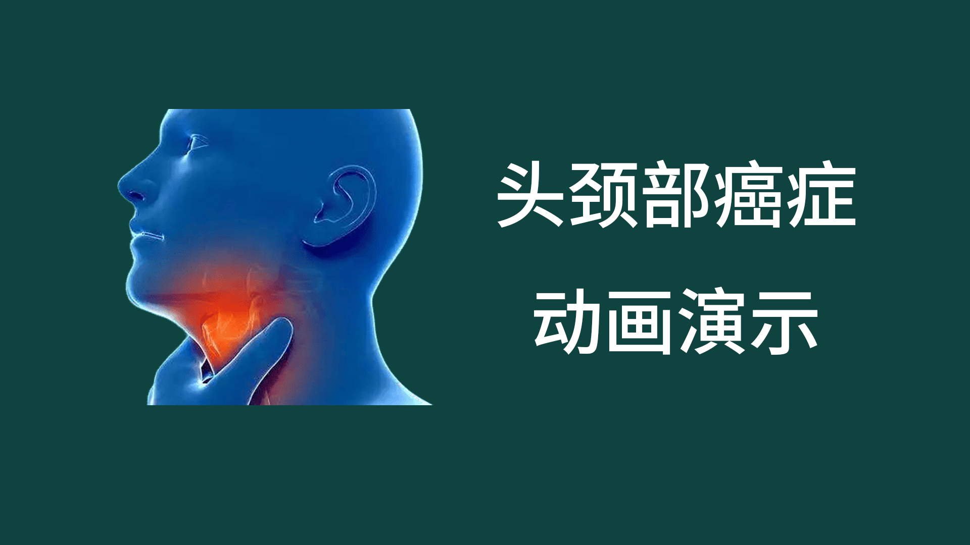 头颈癌