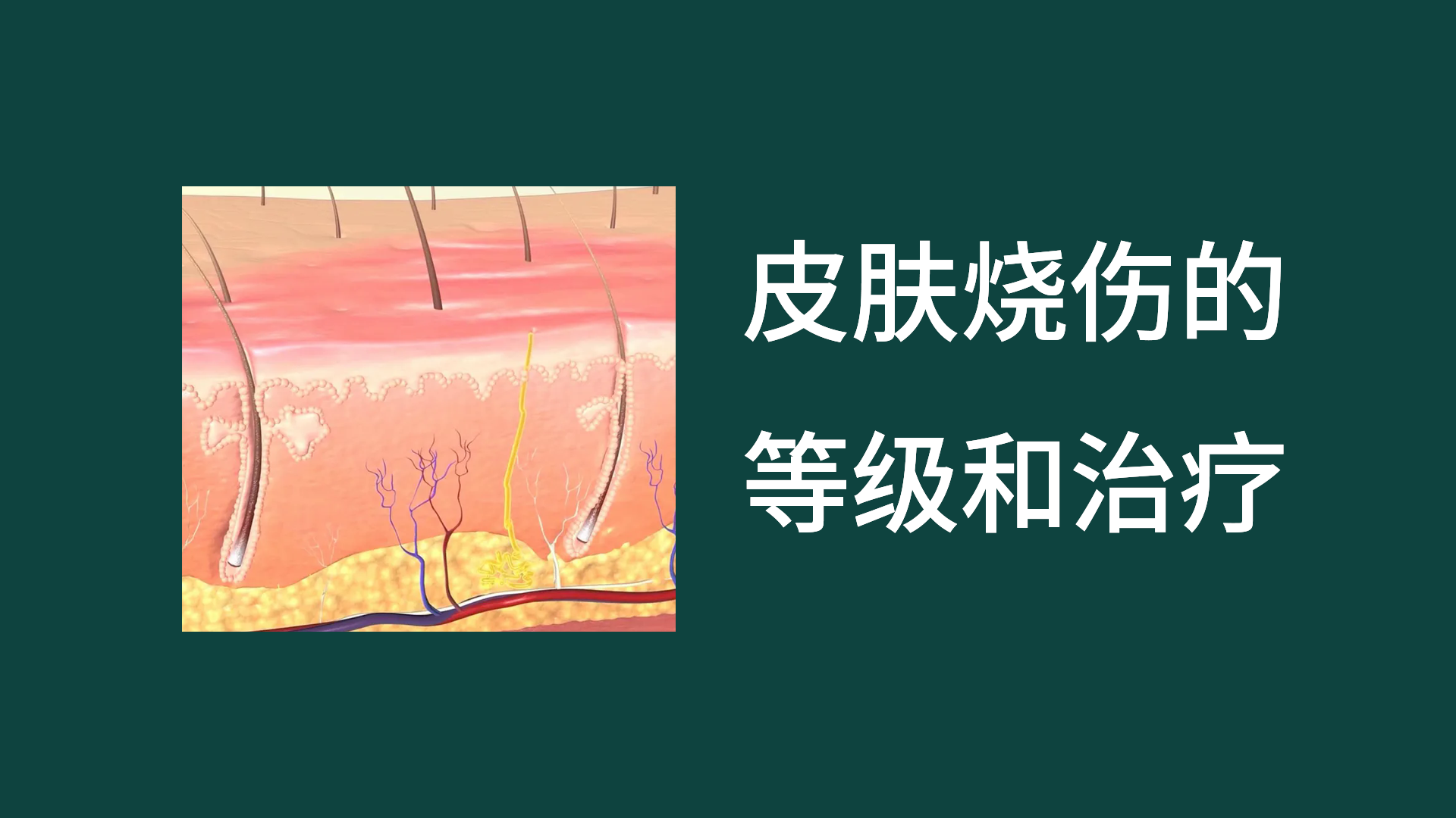 皮肤烧伤